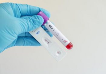 FZO RS izdvojio 1,4 miliona KM za efikasno liječenje hepatitisa C u RS