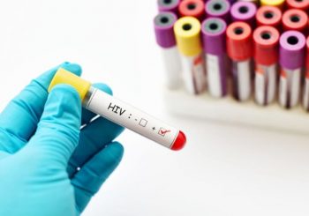 U RS registrovano 113 lica zaraženih HIV-om, ove godine 6 novih